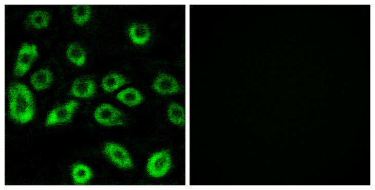 ATP5D Antibody - Immunofluorescence analysis of A549 cells, using ATP5D Antibody. The picture on the right is blocked with the synthesized peptide.
