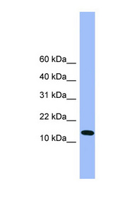 ATP5D Antibody - ATP5D antibody Western blot of Mouse Liver lysate. This image was taken for the unconjugated form of this product. Other forms have not been tested.