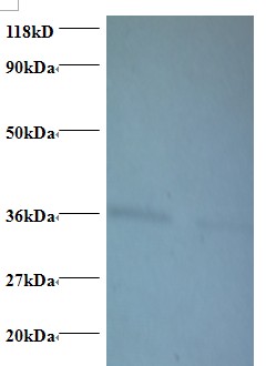 ATP5D Antibody - Western blot of ATP synthase subunit delta, mitochondrial antibody at 2 ug/ml. Lane 1: EC109 whole cell lysate. Lane 2: 293T whole cell lysate. Secondary: Goat polyclonal to Rabbit IgG at 1:15000 dilution. Predicted band size: 18.5 kDa. Observed band size: 36 kDa. This image was taken for the unconjugated form of this product. Other forms have not been tested.