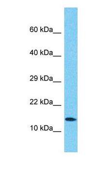 ATP5D Antibody - Western blot of ATP5D Antibody with human Placenta lysate.  This image was taken for the unconjugated form of this product. Other forms have not been tested.