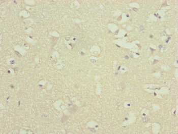 ATP5D Antibody - Immunohistochemistry of paraffin-embedded human brain tissue at dilution of 1:100