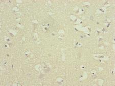 ATP5D Antibody - Immunohistochemistry of paraffin-embedded human brain tissue at dilution of 1:100
