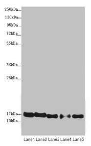 ATP5D Antibody - Western blot All Lanes:ATP5D antibody at 1.94 ug/ml Lane 1: Raji whole cell lysate Lane 2: NIH/3T3 whole cell lysate Lane 3: A549 whole cell lysate Lane 4: MDA-MB-231 whole cell lysate Lane 5: HepG-2 whole cell lysate Secondary Goat polyclonal to rabbit IgG at 1/10000 dilution Predicted band size: 17 kDa Observed band size: 17 kDa