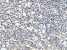 ATP5D Antibody - Immunohistochemistry of paraffin-embedded Human tonsil tissue  using ATP5F1D Polyclonal Antibody at dilution of 1:80(×200)