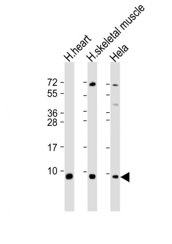 ATP5E Antibody - All lanes: Anti-ATP5E Antibody (C-Term) at 1:2000 dilution. Lane 1: human heart lysate. Lane 2: human skeletal muscle lysate. Lane 3: HeLa whole cell lysate Lysates/proteins at 20 ug per lane. Secondary Goat Anti-Rabbit IgG, (H+L), Peroxidase conjugated at 1:10000 dilution. Predicted band size: 6 kDa. Blocking/Dilution buffer: 5% NFDM/TBST.