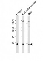 ATP5E Antibody - All lanes: Anti-ATP5E Antibody (C-Term) at 1:2000 dilution. Lane 1: human heart lysate. Lane 2: human skeletal muscle lysate. Lane 3: HeLa whole cell lysate Lysates/proteins at 20 ug per lane. Secondary Goat Anti-Rabbit IgG, (H+L), Peroxidase conjugated at 1:10000 dilution. Predicted band size: 6 kDa. Blocking/Dilution buffer: 5% NFDM/TBST.