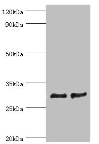 ATP5F1 Antibody - Western blot All lanes: ATP synthase F (0) complex subunit B1, mitochondrial antibody at 4µg/ml Lane 1: Mouse heart tissue Lane 2: Mouse skeletal muscle tissue Secondary Goat polyclonal to rabbit IgG at 1/10000 dilution Predicted band size: 29 kDa Observed band size: 29 kDa