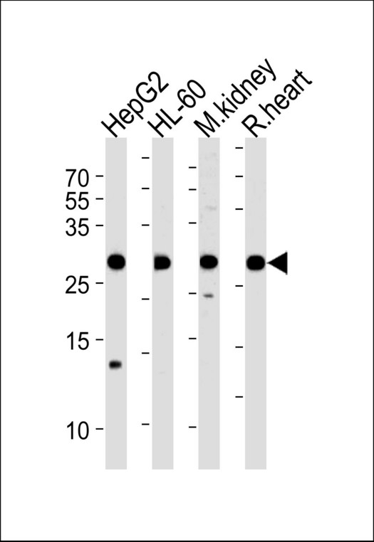 ATP5F1 Antibody - ATP5F1 Antibody western blot of HepG2, HL-60 cell line, mouse kidney and rat heart tissue lysates (35 ug/lane). The ATP5F1 antibody detected the ATP5F1 protein (arrow).
