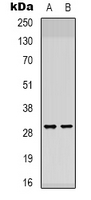 ATP5F1 Antibody - Western blot analysis of ATP5F1 expression in K562 (A); NIH3T3 (B) whole cell lysates.