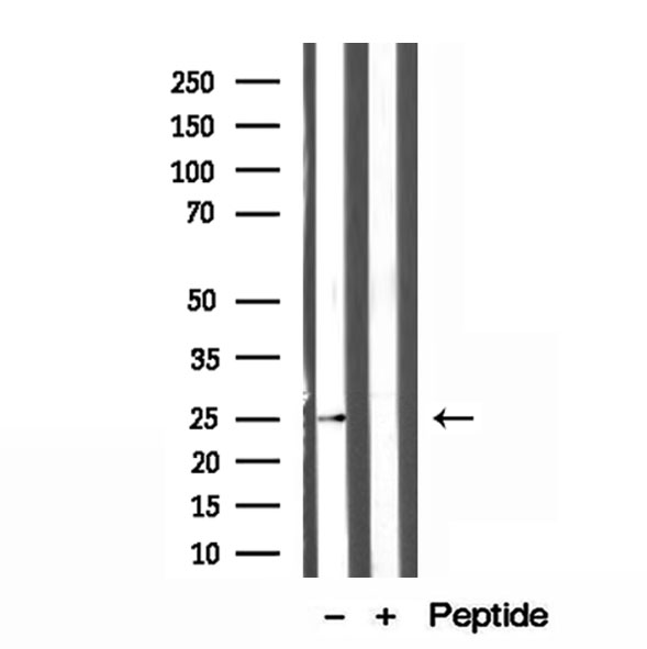 ATP5F1 Antibody - Western blot analysis of extracts of mouse heart tissue using ATP5F1 antibody.