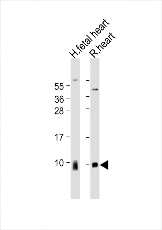 ATP5G1 / ATP5G Antibody - All lanes: Anti-ATP5G1 Antibody (Center) at 1:2000 dilution Lane 1: human fetal heart lysate Lane 2: rat heart lysate Lysates/proteins at 20 µg per lane. Secondary Goat Anti-Rabbit IgG, (H+L), Peroxidase conjugated at 1/10000 dilution. Predicted band size: 14 kDa Blocking/Dilution buffer: 5% NFDM/TBST.