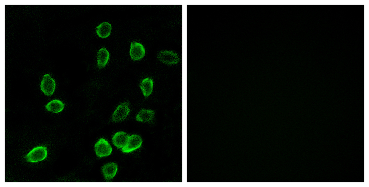 ATP5G3 Antibody - Immunofluorescence analysis of A549 cells, using ATP5G3 Antibody. The picture on the right is blocked with the synthesized peptide.