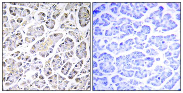 ATP5G3 Antibody - Immunohistochemistry analysis of paraffin-embedded human pancreas tissue, using ATP5G3 Antibody. The picture on the right is blocked with the synthesized peptide.