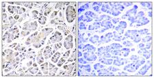 ATP5G3 Antibody - Peptide - + Immunohistochemistry analysis of paraffin-embedded human pancreas tissue using ATP5G3 antibody.