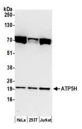 ATP5H Antibody - Detection of human ATP5H by western blot. Samples: Whole cell lysate (50 µg) from HeLa, HEK293T, and Jurkat cells prepared using NETN lysis buffer. Antibody: Affinity purified rabbit anti-ATP5H antibody used for WB at 0.1 µg/ml. Detection: Chemiluminescence with an exposure time of 30 seconds.