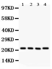 ATP5H Antibody - ATP5H antibody Western blot. All lanes: Anti ATP5H at 0.5 ug/ml. Lane 1: Rat Brain Tissue Lysate at 50 ug. Lane 2: Mouse Brain Tissue Lysate at 50 ug. Lane 3: Human Placenta Tissue Lysate at 50 ug. Lane 4: HELA Whole Cell Lysate at 40 ug. Predicted band size: 22 kD. Observed band size: 22 kD.
