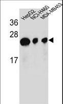 ATP5H Antibody - ATP5H Antibody western blot of HepG2,NCI-H460,MDA-MB453 cell line lysates (35 ug/lane). The ATP5H antibody detected the ATP5H protein (arrow).