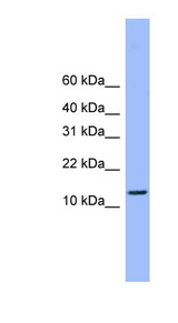 ATP5H Antibody - ATP5H antibody Western blot of MCF7 cell lysate. This image was taken for the unconjugated form of this product. Other forms have not been tested.