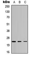 ATP5H Antibody - Western blot analysis of ATP5H expression in HeLa (A); SHSY5Y (B); Rat muscle (C) whole cell lysates.