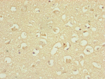 ATP5H Antibody - Immunohistochemistry of paraffin-embedded human brain tissue at dilution of 1:100