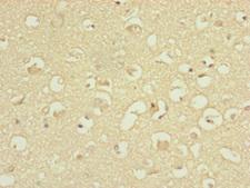 ATP5H Antibody - Immunohistochemistry of paraffin-embedded human brain tissue at dilution of 1:100