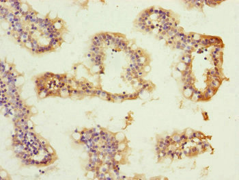 ATP5H Antibody - Immunohistochemistry of paraffin-embedded human small intestine tissue at dilution of 1:100