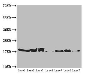 ATP5H Antibody - Western blot All Lanes:ATP5H antibody at 5.16 ug/ml Lane 1: Mouse kidney tissue Lane 2: Mouse liver tissue Lane 3: Mouse brain tissue Lane 4: Hela whole cell lysate Lane 5: HepG-2 whole cell lysate Lane 6: PC-3 whole cell lysate Lane 7: U251 whole cell lysate Secondary Goat polyclonal to rabbit IgG at 1/10000 dilution Predicted band size: 19,16 kDa Observed band size: 18 kDa