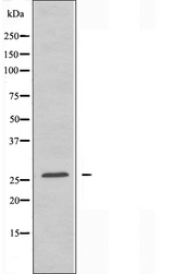 ATP5H Antibody - Western blot analysis of extracts of HepG2 cells using ATP5H antibody.