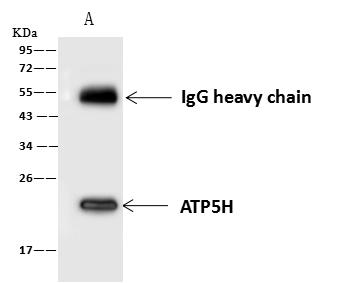 ATP5H Antibody - ATP5H was immunoprecipitated using: Lane A: 0.5 mg PC-3 Whole Cell Lysate. 4 uL anti-ATP5H rabbit polyclonal antibody and 60 ug of Immunomagnetic beads Protein A/G. Primary antibody: Anti-ATP5H rabbit polyclonal antibody, at 1:100 dilution. Secondary antibody: Goat Anti-Rabbit IgG (H+L)/HRP at 1/10000 dilution. Developed using the ECL technique. Performed under reducing conditions. Predicted band size: 18 kDa. Observed band size: 22 kDa.