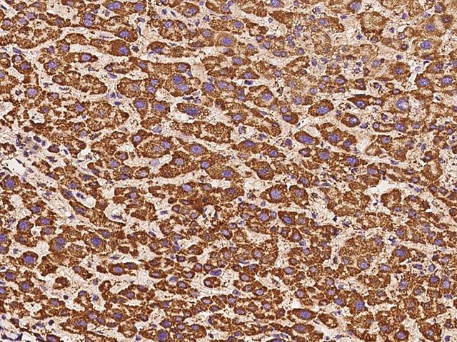 ATP5H Antibody - Immunochemical staining of human ATP5H in human liver with rabbit polyclonal antibody at 1:200 dilution, formalin-fixed paraffin embedded sections.