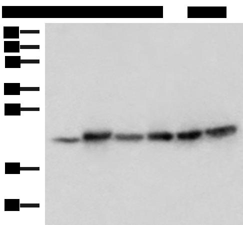 ATP5H Antibody - Western blot analysis of Mouse skeletal muscle tissue Mouse kidney tissue PC-3 Jurkat HepG2 and Hela cell lysates  using ATP5PD Polyclonal Antibody at dilution of 1:300
