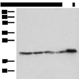 ATP5H Antibody - Western blot analysis of Hela HepG2 Jurkat and PC3 cell Mouse kidney tissue lysates  using ATP5PD Polyclonal Antibody at dilution of 1:550