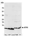 ATP5I Antibody - Detection of human and mouse ATP5I by western blot. Samples: Whole cell lysate (50 µg) from HeLa, HEK293T, Jurkat, mouse TCMK-1, and mouse NIH 3T3 cells prepared using NETN lysis buffer. Antibody: Affinity purified rabbit anti-ATP5I antibody used for WB at 0.1 µg/ml. Detection: Chemiluminescence with an exposure time of 10 seconds.