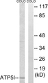ATP5I Antibody - Western blot analysis of lysates from COLO cells, using ATP5I Antibody. The lane on the right is blocked with the synthesized peptide.