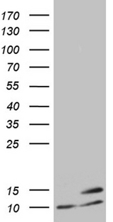 ATP5I Antibody - HEK293T cells were transfected with the pCMV6-ENTRY control. (Left lane) or pCMV6-ENTRY ATP5I. (Right lane) cDNA for 48 hrs and lysed