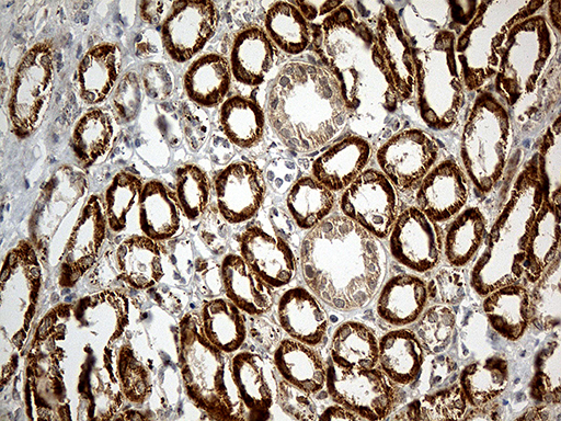 ATP5I Antibody - Immunohistochemical staining of paraffin-embedded Human Kidney tissue within the normal limits using anti-ATP5I mouse monoclonal antibody. (Heat-induced epitope retrieval by 1mM EDTA in 10mM Tris buffer. (pH8.5) at 120°C for 3 min. (1:500)
