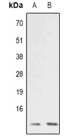 ATP5I Antibody - Western blot analysis of ATP5I expression in RT4 (A); COLO205 (B) whole cell lysates.