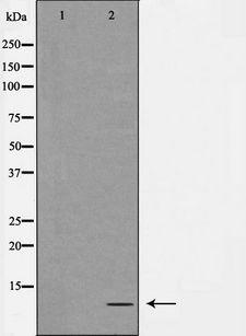 ATP5I Antibody - Western blot analysis of extracts of COLO cells using ATP5I antibody. The lane on the left is treated with the antigen-specific peptide.