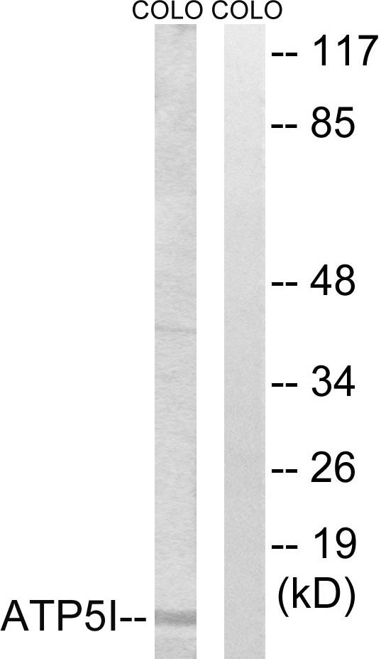 ATP5I Antibody - Western blot analysis of extracts from COLO cells, using ATP5I antibody.