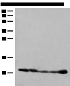 ATP5I Antibody - Western blot analysis of 293T cell PC-3 cell Human liver tissue lysates  using ATP5I Polyclonal Antibody at dilution of 1:400