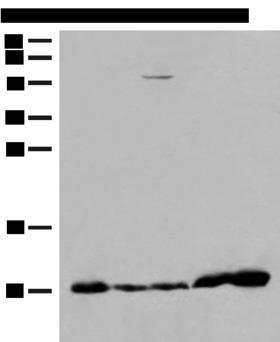 ATP5I Antibody - Western blot analysis of 293T cell Human fetal liver tissue Human heart tissue lysates  using ATP5I Polyclonal Antibody at dilution of 1:200