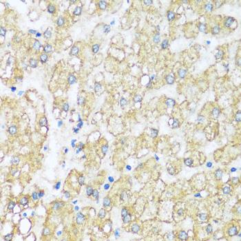 ATP5I Antibody - Immunohistochemistry of paraffin-embedded Human liver using ATP5I Polyclonal Antibody at dilution of 1:100 (40x lens).