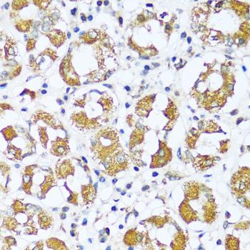 ATP5I Antibody - Immunohistochemistry of paraffin-embedded Human stomach using ATP5I Polyclonal Antibody at dilution of 1:100 (40x lens).
