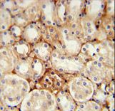 ATP5J2 / F1Fo-ATPase Antibody - ATP5J2 Antibody immunohistochemistry of formalin-fixed and paraffin-embedded mouse kidney tissue followed by peroxidase-conjugated secondary antibody and DAB staining.