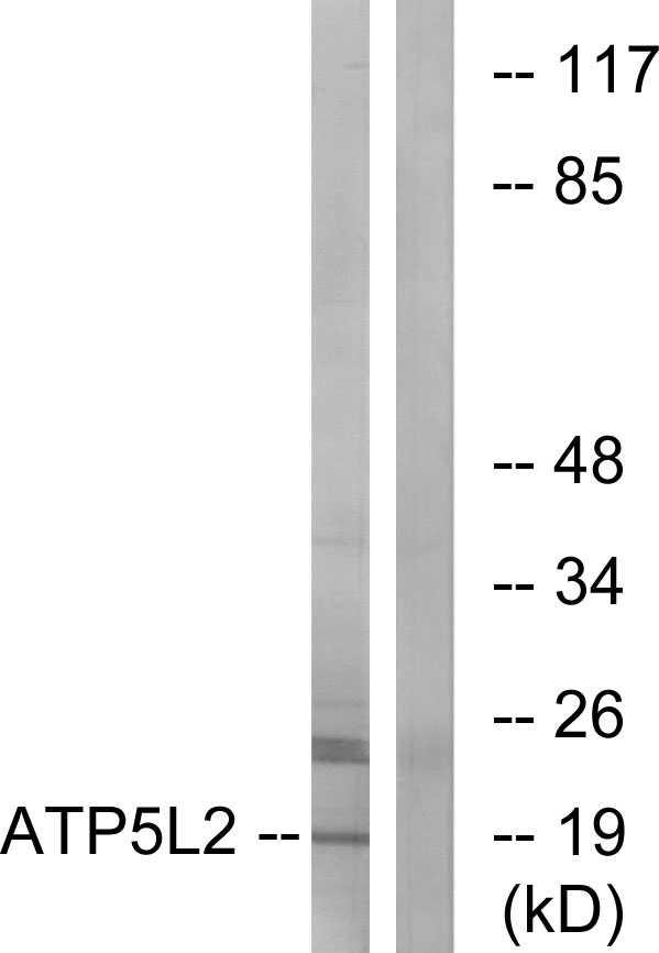 ATP5L2 Antibody - Western blot analysis of lysates from A549 cells, using ATP5L2 Antibody. The lane on the right is blocked with the synthesized peptide.