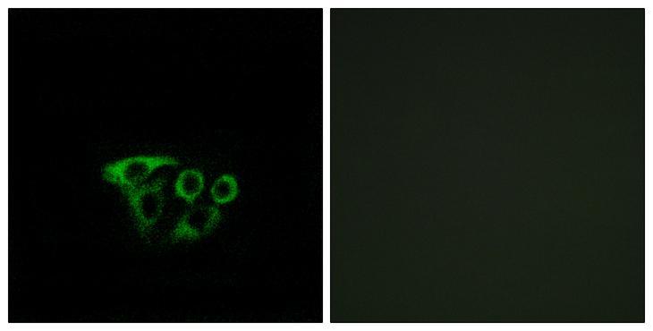 ATP5L2 Antibody - Peptide - + Immunofluorescence analysis of A549 cells, using ATP5L2 antibody.