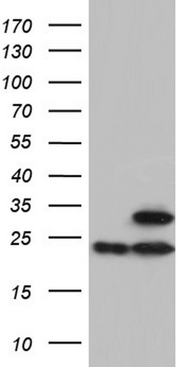 ATP5O Antibody - HEK293T cells were transfected with the pCMV6-ENTRY control (Left lane) or pCMV6-ENTRY ATP5O (Right lane) cDNA for 48 hrs and lysed. Equivalent amounts of cell lysates (5 ug per lane) were separated by SDS-PAGE and immunoblotted with anti-ATP5O.