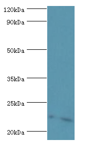 ATP5O Antibody - Western blot. All lanes: ATP synthase subunit O, mitochondrial antibody at 3 ug/ml+HepG2 whole cell lysate. Secondary antibody: Goat polyclonal to rabbit at 1:10000 dilution. Predicted band size: 23 kDa. Observed band size: 23 kDa Immunohistochemistry.