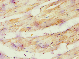 ATP5O Antibody - Immunohistochemistry of paraffin-embedded human skeletal muscle using antibody at 1:100 dilution.