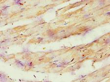 ATP5O Antibody - Immunohistochemistry of paraffin-embedded human skeletal muscle using antibody at 1:100 dilution.